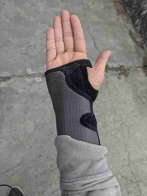 गाउट-वातरक्त-का-इलाज-gout-disease-ka-ilaj-in-hindi