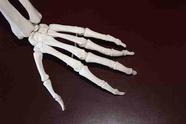 गाउट-वातरक्त-का-निदान-इलाज-gout-disease-diagnosis-in-hindi