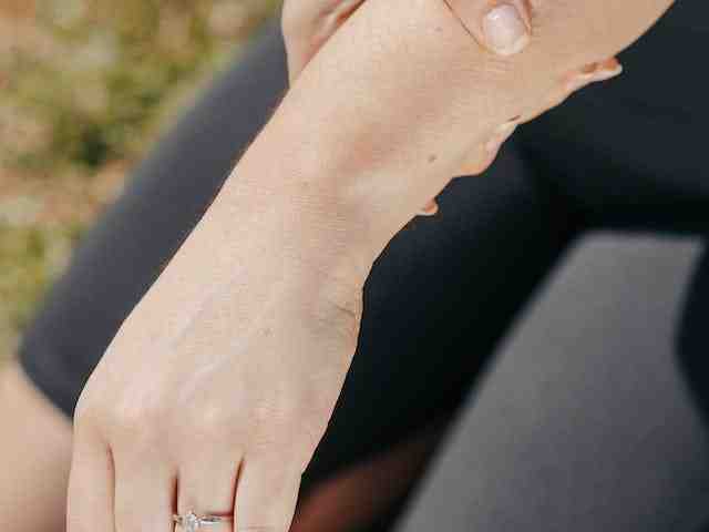 मोच-स्प्रेन-के-लक्षण-कारण-इलाज-sprain-in-hindi