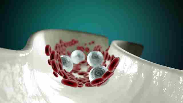 atherosclerosis-in-hindi