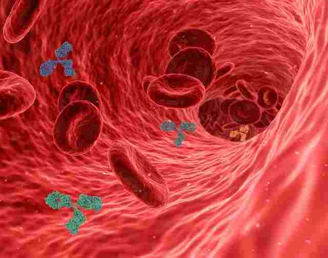 एथेरोस्क्लेरोसिस-धमनीकाठिन्य-के-लक्षण-atherosclerosis-symptoms-in-hindi