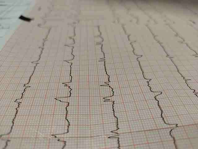 एनजाइना-का-निदान-और-इलाज-angina-diagnosis-in-hindi